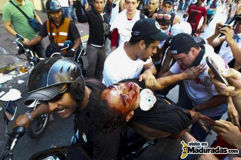 muere estudiante en protesta en venezuela